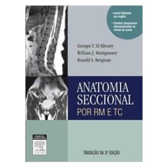 ANATOMIA SECCIONAL POR RM E TC