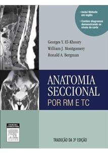 ANATOMIA SECCIONAL POR RM E TC